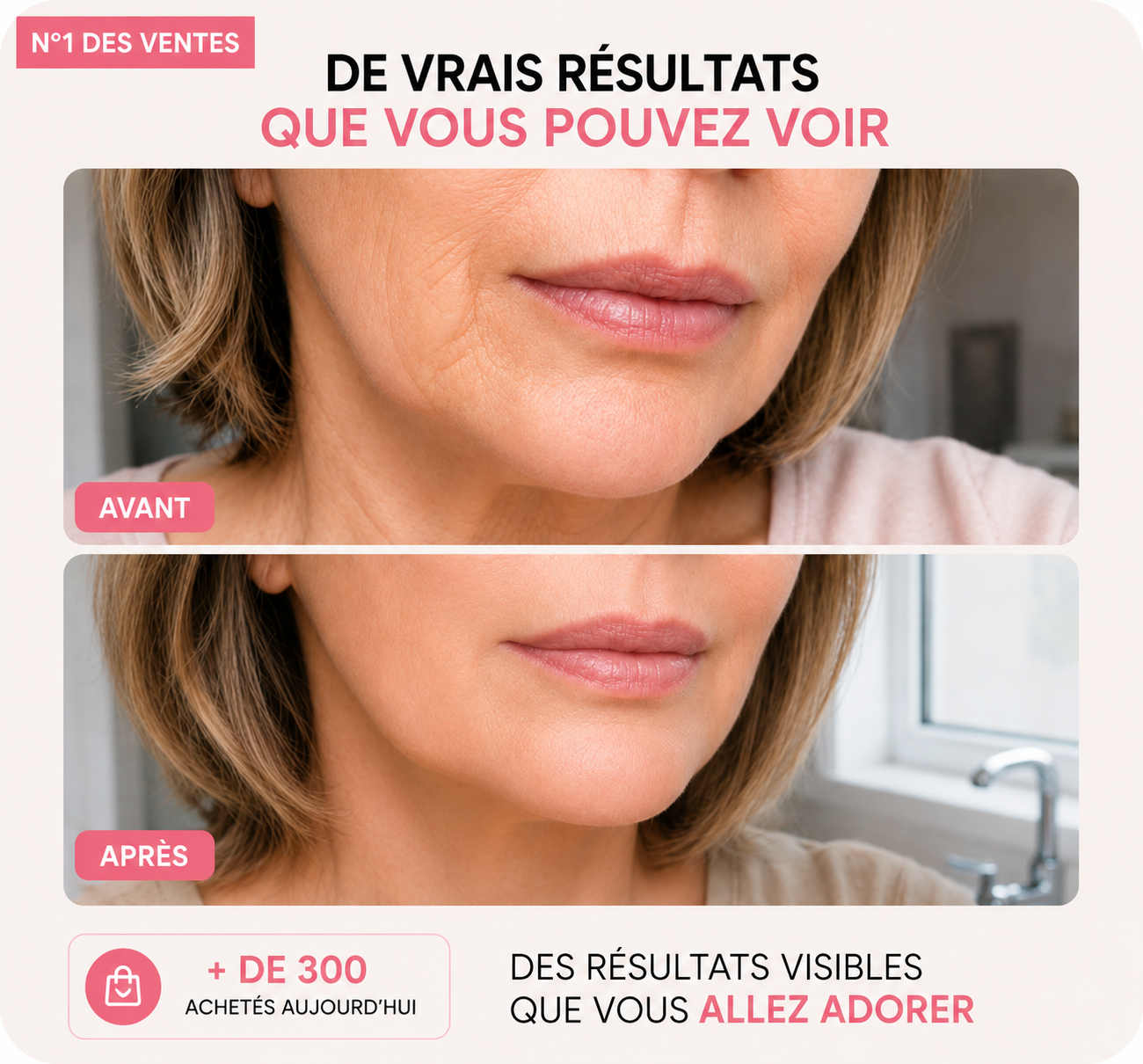 Baume PDRN Collagène Multi-Volume